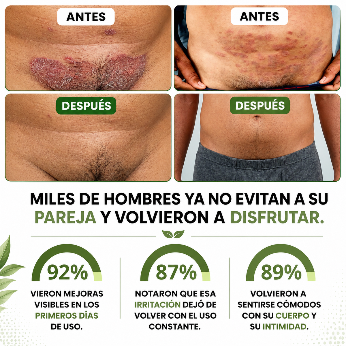 Dermafung Forte - Crema de Cuidado de los Pliegues de la Piel.