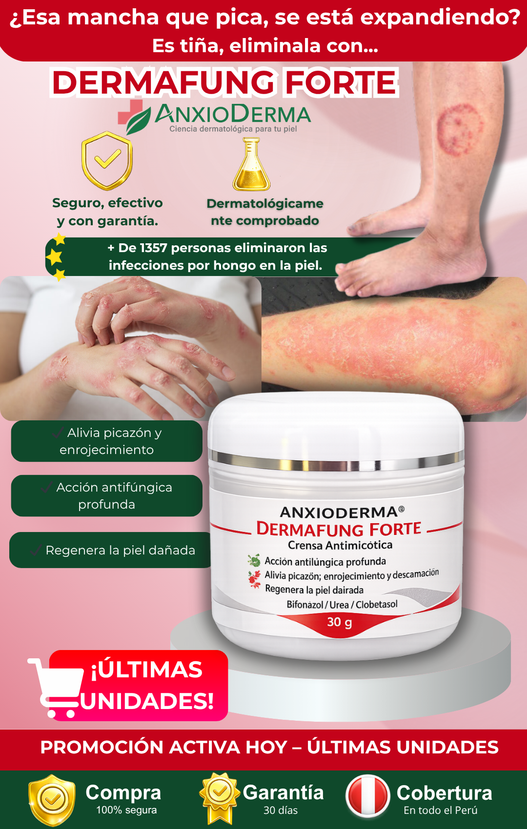 Crema Antifúngica  para Tiña y hongos en la Piel – Dermafung Forte